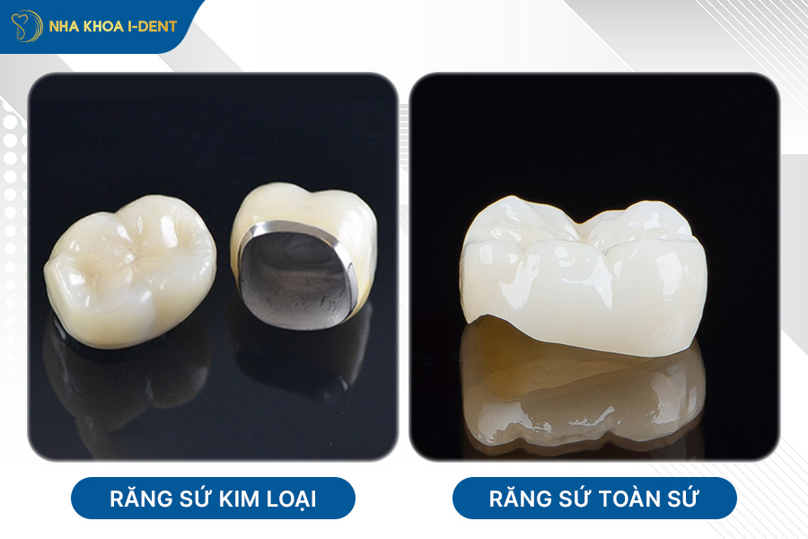 bọc răng sứ có hết hô không