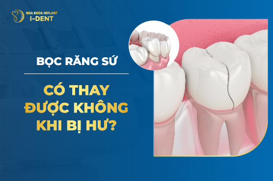 Bọc Răng Sứ Có Thay Được Không Khi Bị Hư?