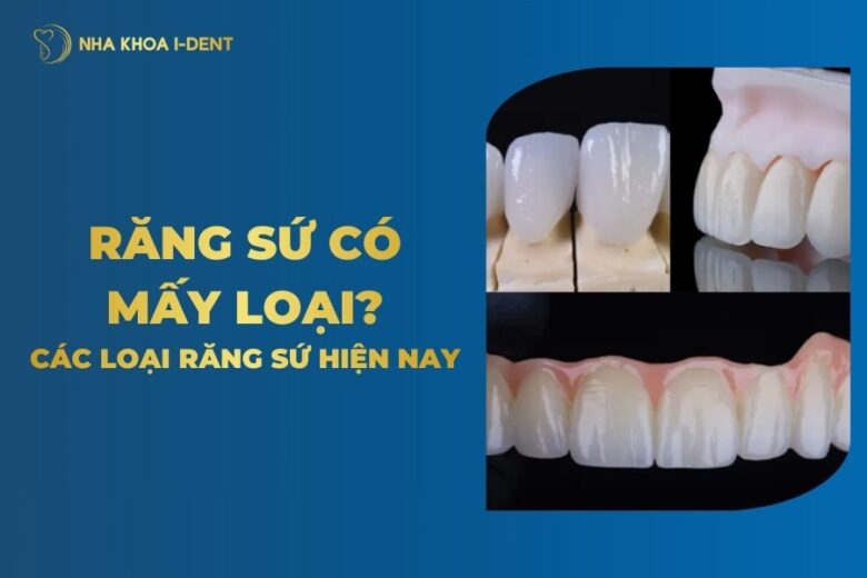 Răng Sứ Có Mấy Loại? Các Loại Răng Sứ Trên Thị Trường