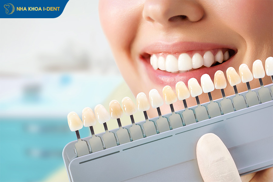 cách kiểm tra thẻ bảo hành răng