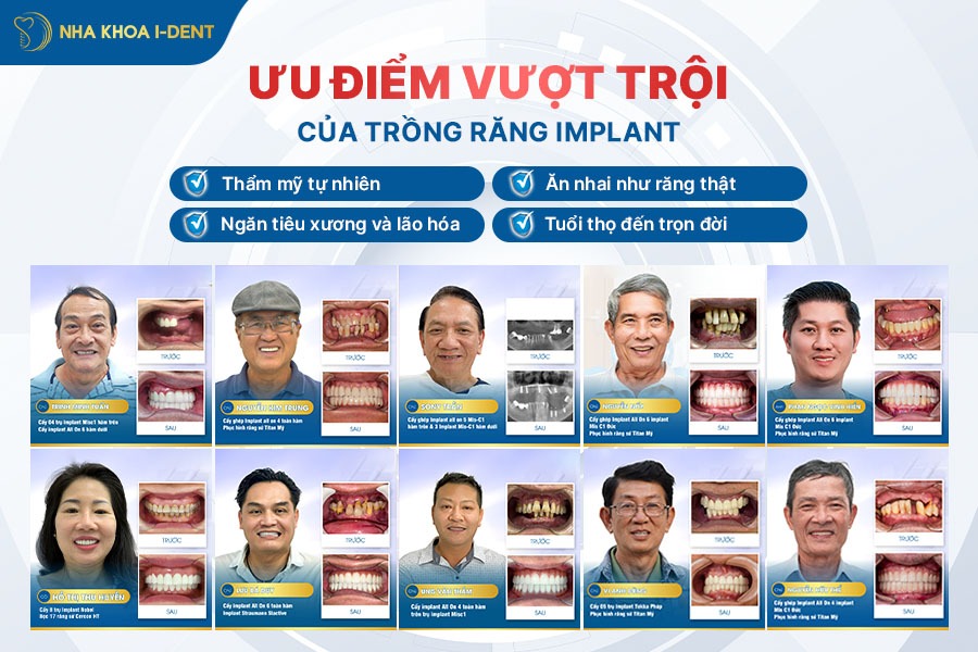 cấy implant có nguy hiểm không