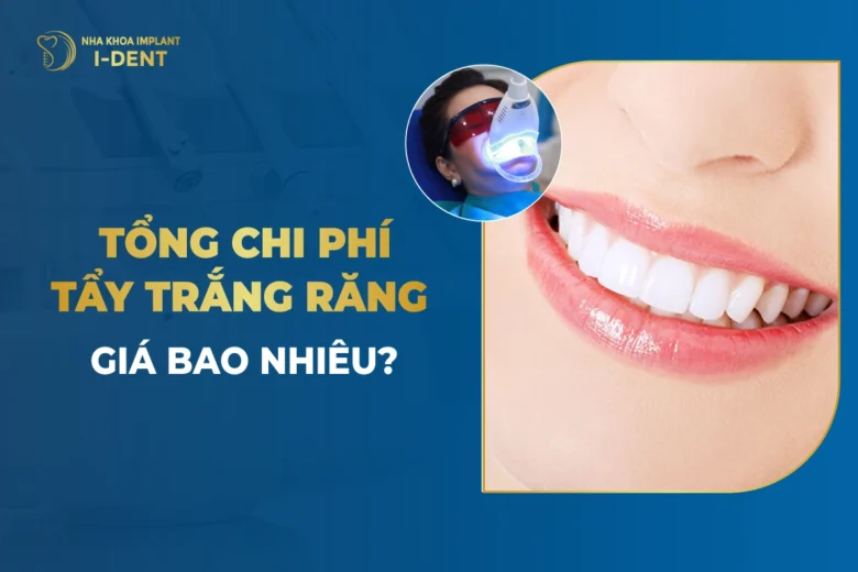 Tẩy Trắng Răng Giá Bao Nhiêu? Bảng Giá 2026