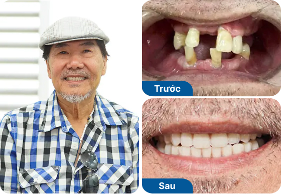 Chú Cao Văn Đồng