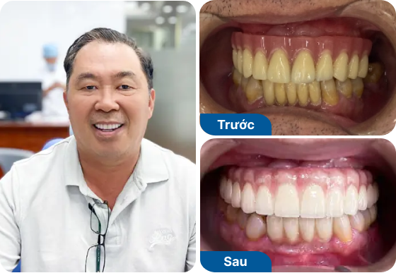 Chú Võ Ngọc Lâm