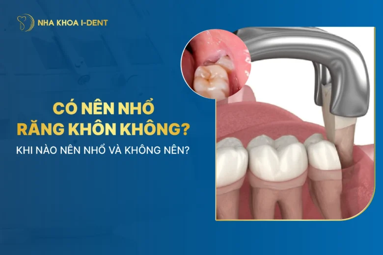 Có Nên Nhổ Răng Khôn Không? Khi Nào Nên Nhổ Và Không Nên?
