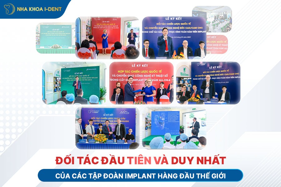 có nên trồng răng implant không