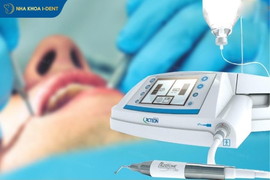 giá nhổ răng hàm bị sâu