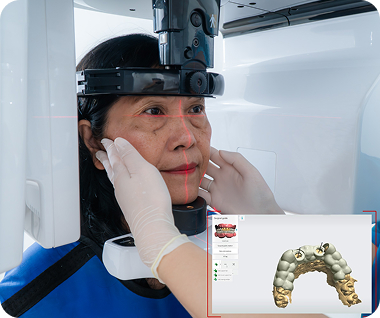 3D Implant Navigation Technology