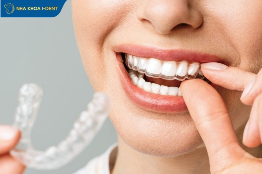 niềng răng invisalign có tốt không