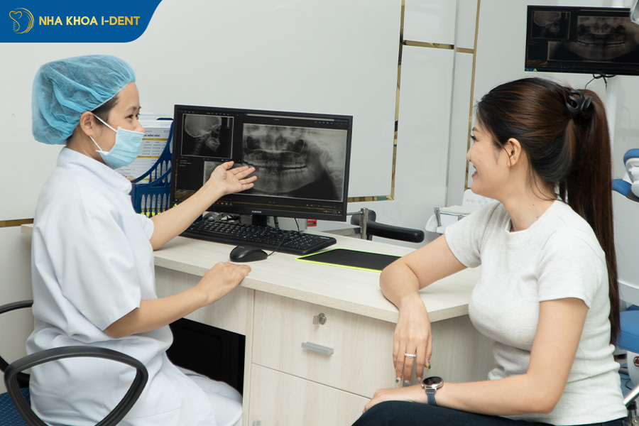 kết quả niềng răng hô