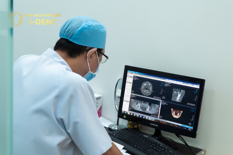 niềng răng cho trẻ 12 tuổi giá bao nhiêu