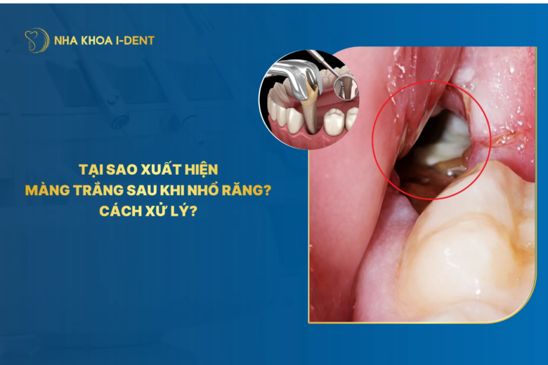 màng trắng sau khi nhổ răng