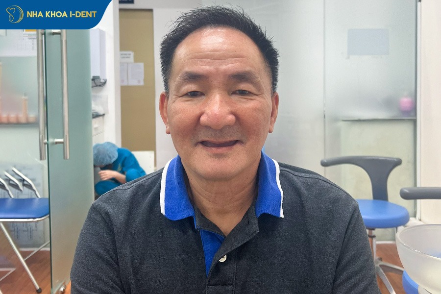 Mất răng hàm trên