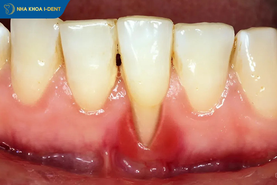 người gặp vấn đề về xương hàm