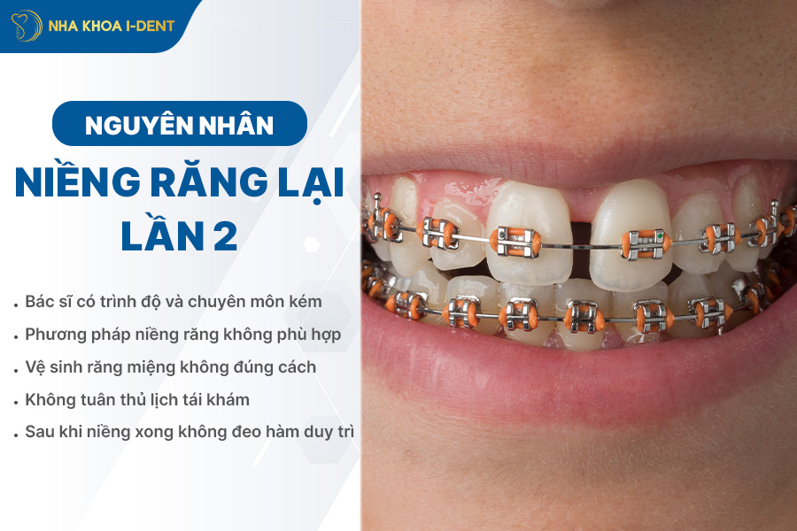 nguyên nhân niềng răng lần 2