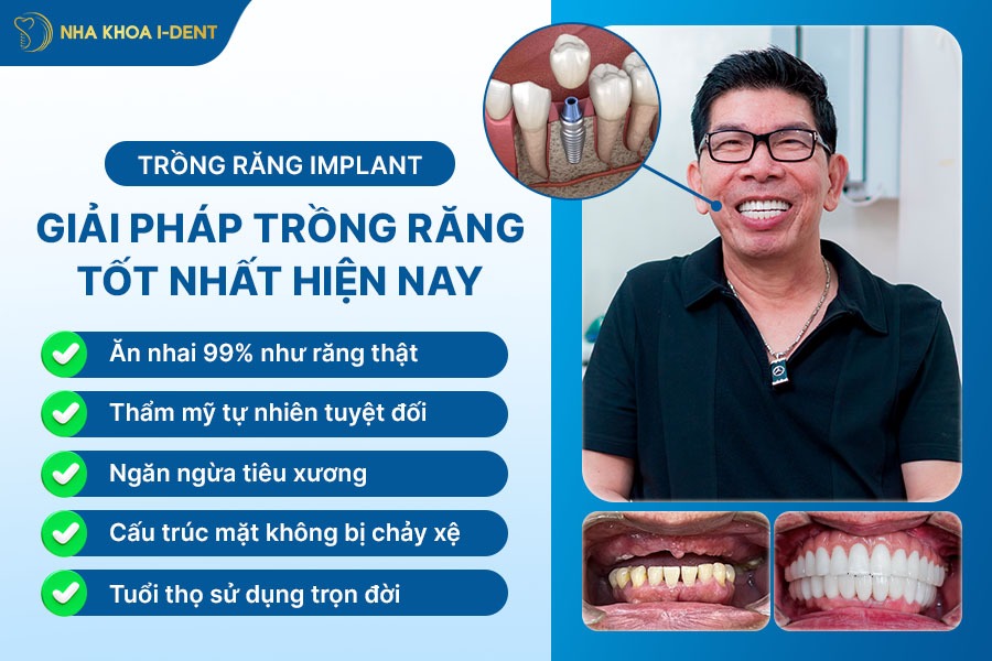nhổ răng bao lâu mới trồng lại được