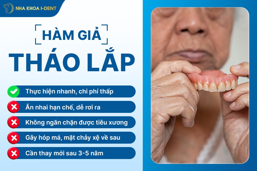 nhổ răng bao lâu thì trồng răng được