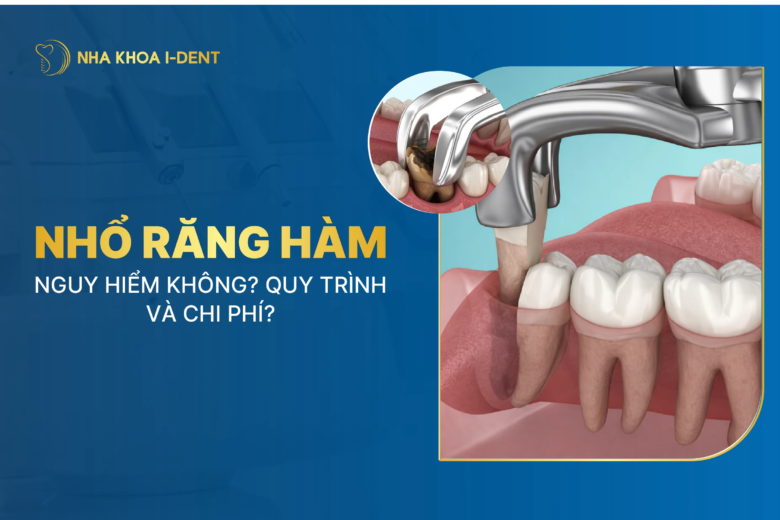 nhổ răng hàm