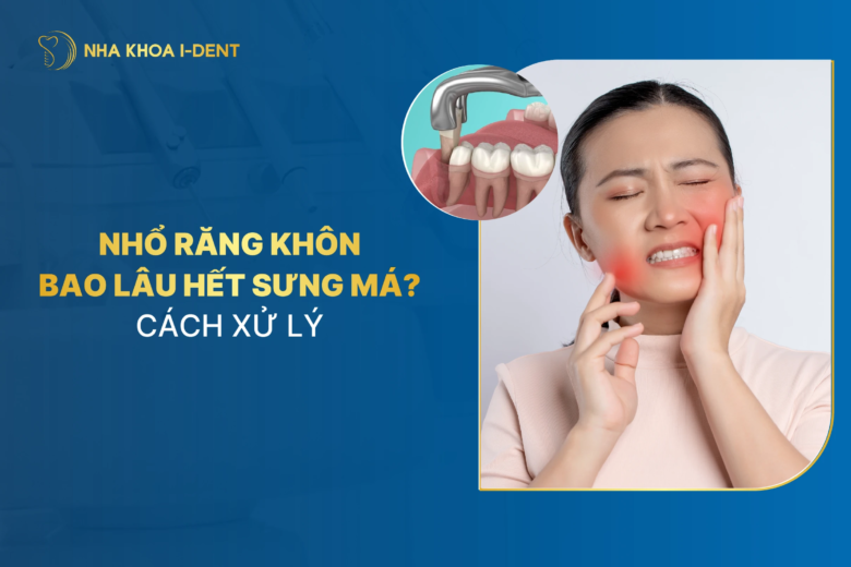 nhổ răng khôn bao lâu hết sưng