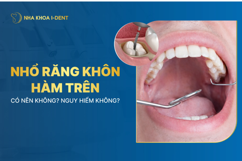 nhổ răng khôn hàm trên