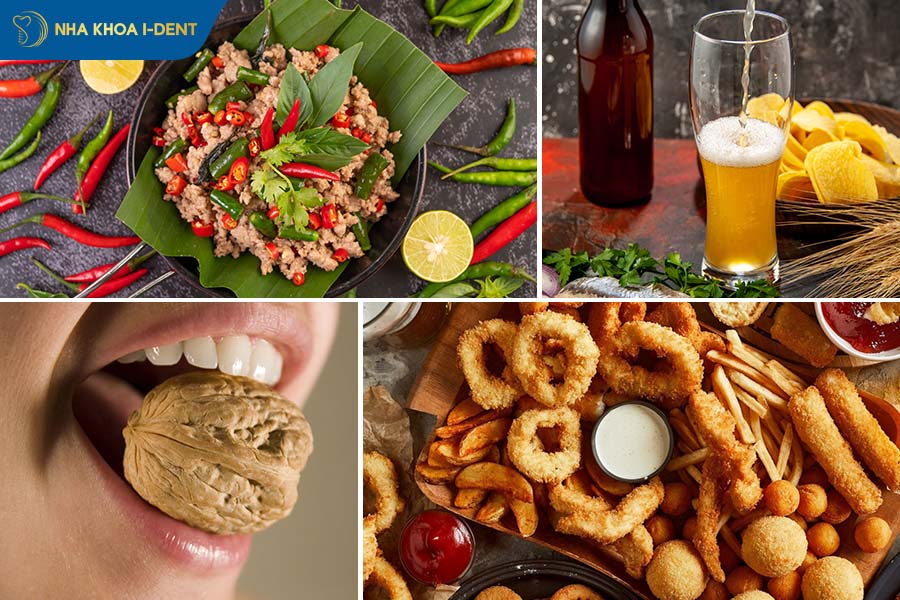 nhổ răng khôn sau bao lâu thì ăn được