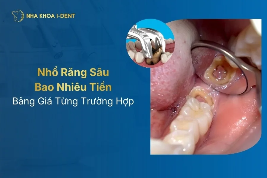Nho Rang Sau Bao Nhieu Tien