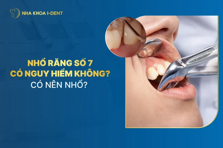 Nhổ Răng Số 7: Ảnh Hưởng Gì? Có Nên Trồng Lại? Có Nên Nhổ?
