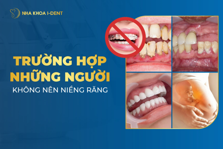 Trường Hợp Những Người Không Nên Niềng Răng Cần Tránh
