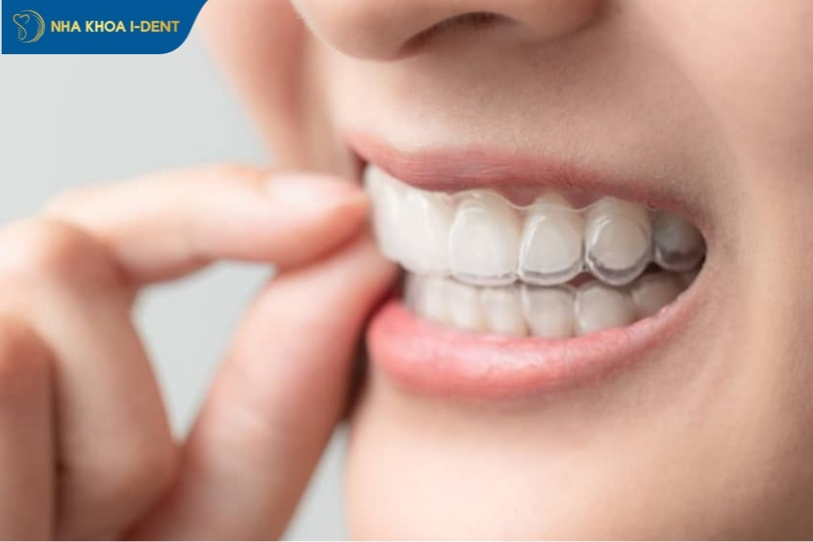 niềng răng invisalign có hiệu quả không