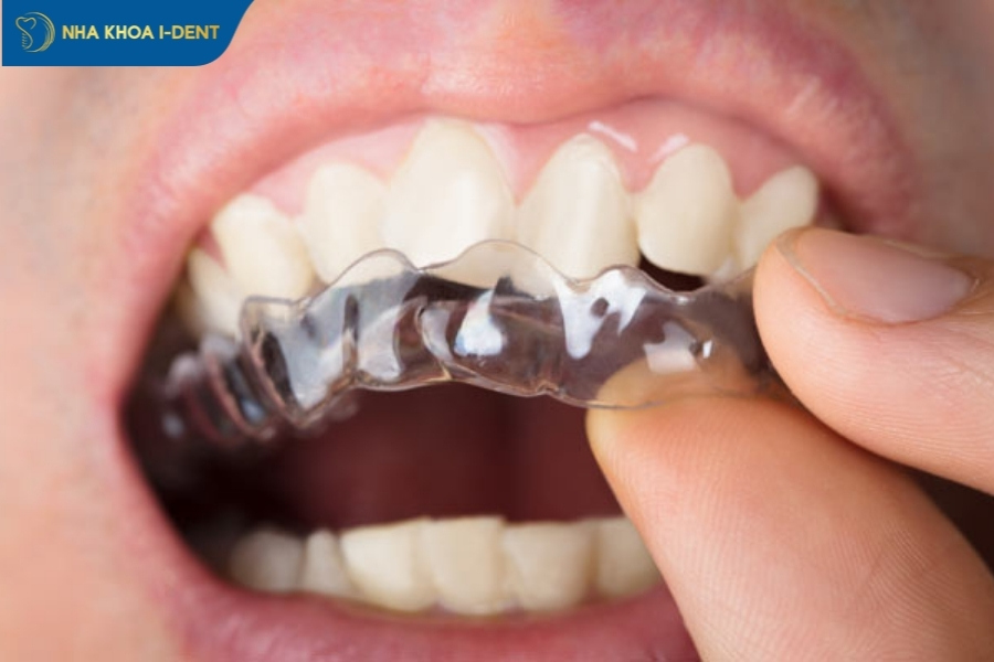 niềng invisalign có hiệu quả không