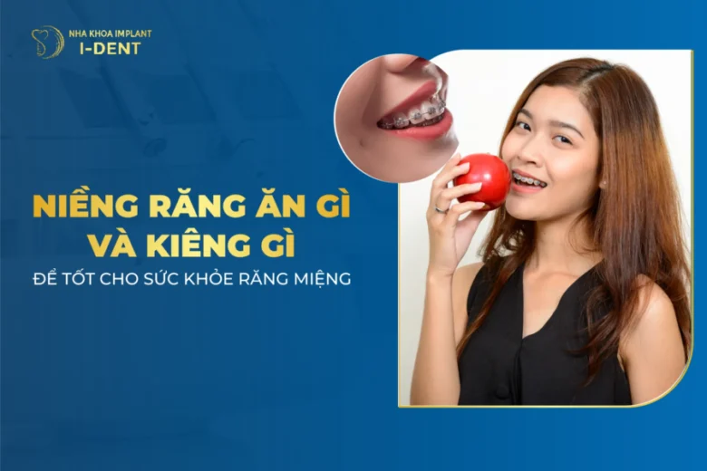 Niềng Răng Ăn Gì Và Kiêng Gì Để Tốt Cho Sức Khỏe Răng Miệng