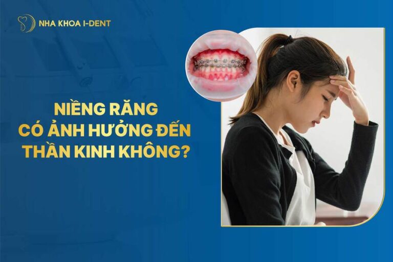 Niềng răng có ảnh hưởng đến thần kinh không? Niềng răng có ảnh hưởng đến thần kinh không?