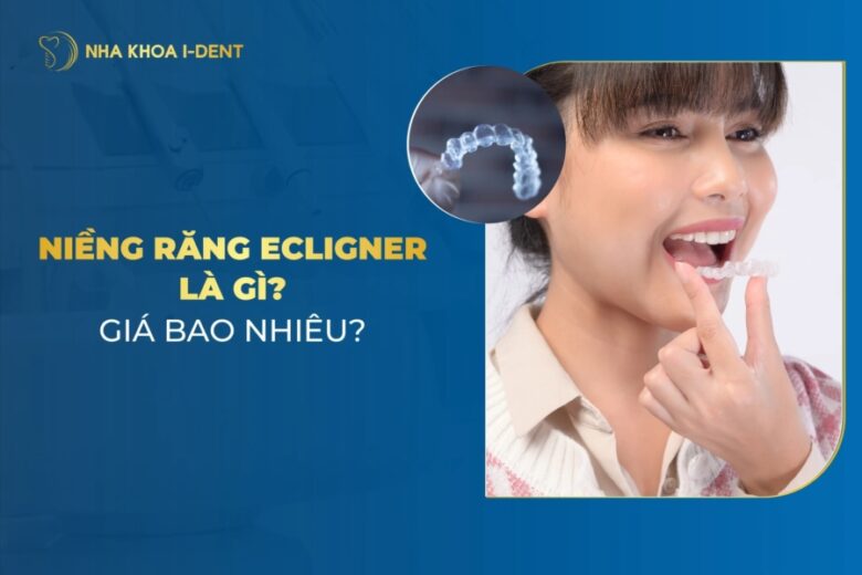 Niềng Răng Ecligner Là Gì? Giá Tiền Và Ưu, Nhược Điểm