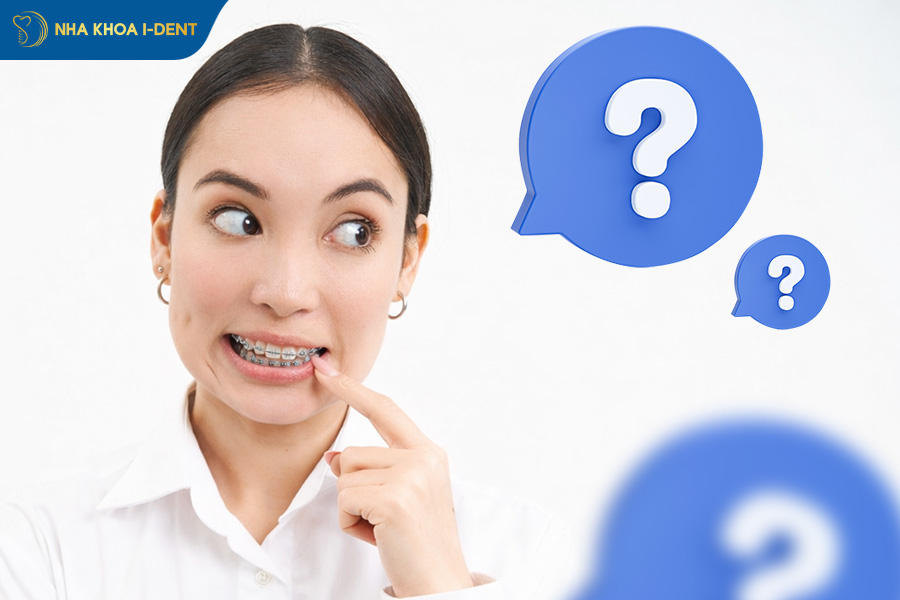 niềng răng lần 2 mất bao lâu