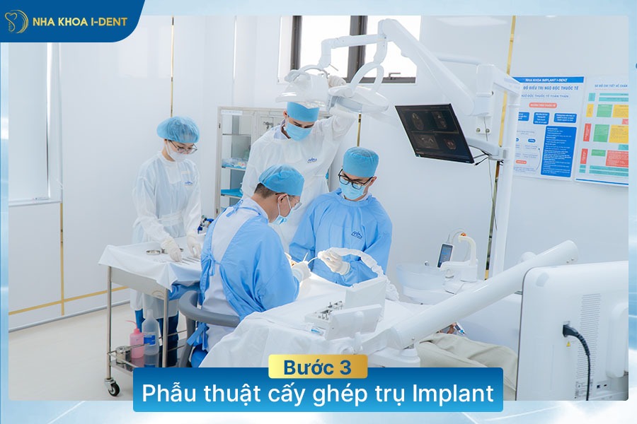 quy trình làm răng implant