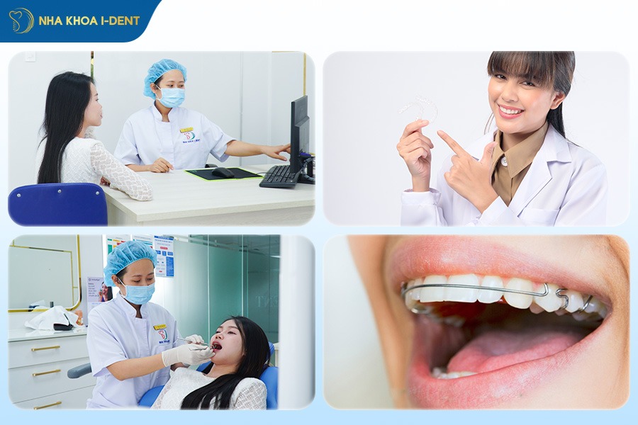 Quy trình niềng răng Ecligner