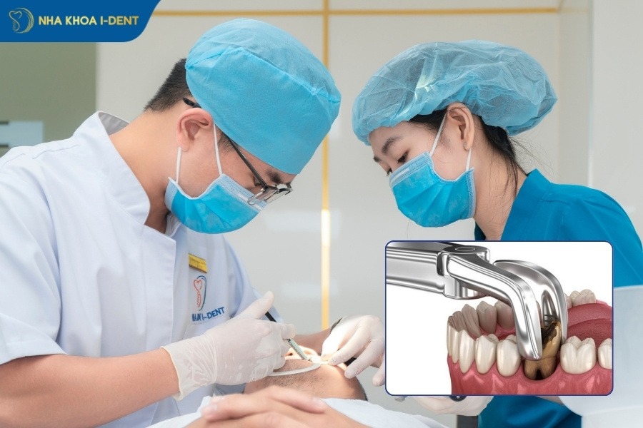 răng cấm có nên nhổ không