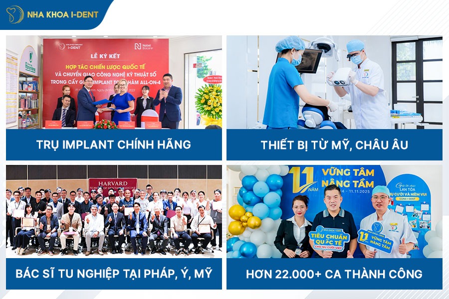 có nên trồng răng implant không