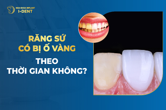Răng Sứ Có Bị Vàng? Nguyên Nhân Và Cách Khắc Phục