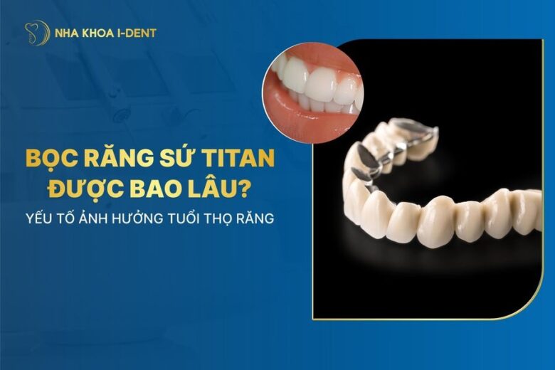 Bọc Răng Sứ Titan Được Bao Lâu? Yếu Tố Ảnh Hưởng Tuổi Thọ Răng