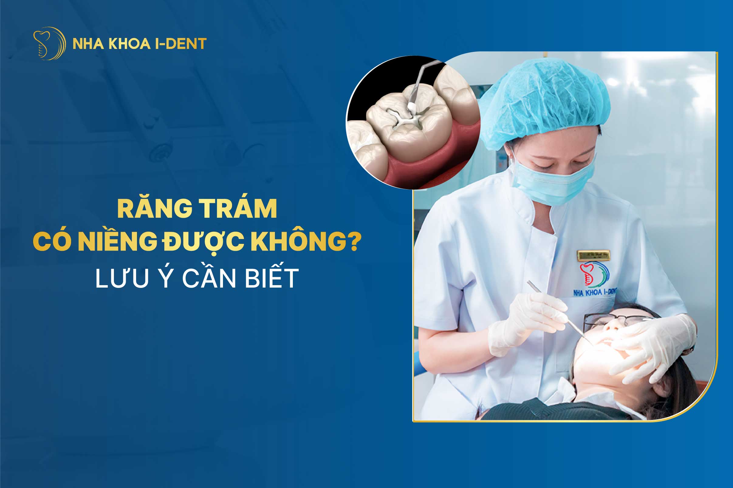 Răng Trám Có Niềng Được Không? Lưu Ý Cần Biết
