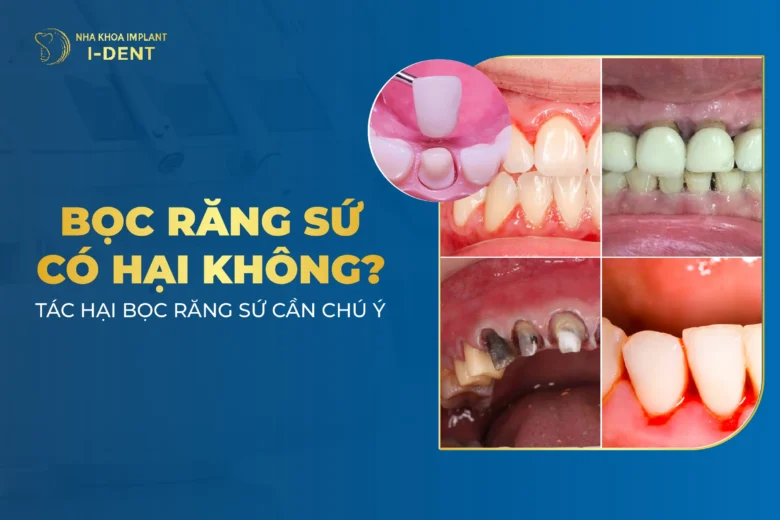 Bọc Răng Sứ Có Hại Không? 11 Tác Hại Cần Lưu Ý