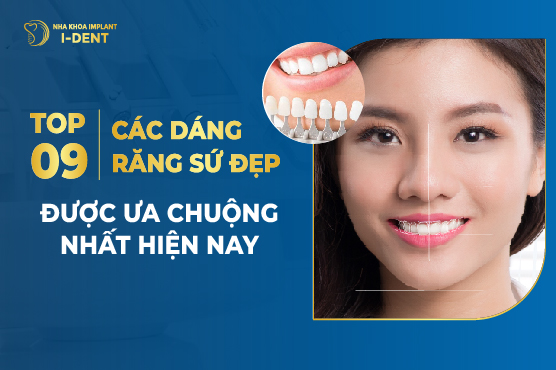 9 Mẫu Dáng Răng Sứ Đẹp Tự Nhiên Được Yêu Thích Nhất 2026