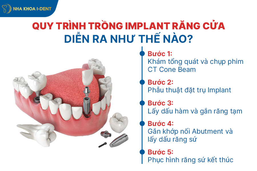 trồng implant cho răng cửa