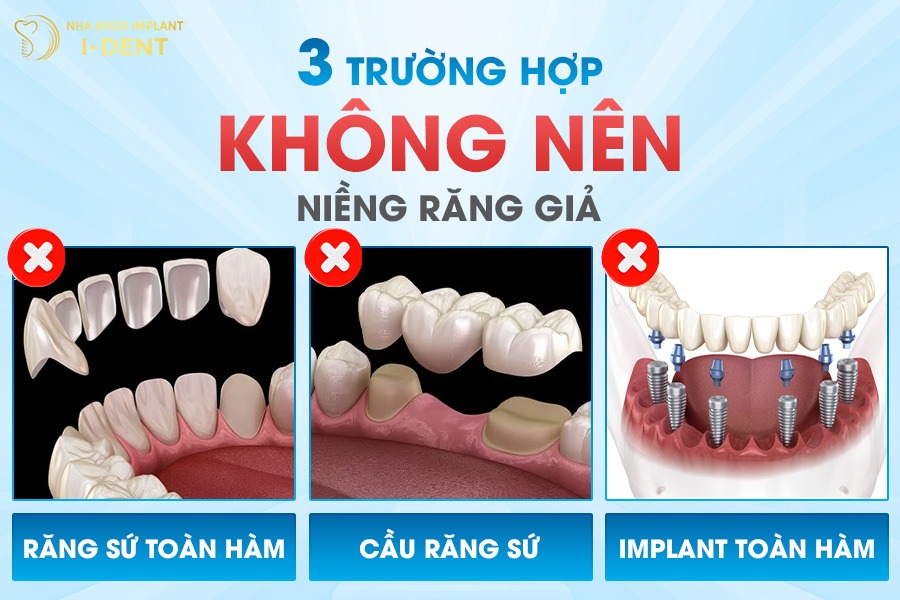 Trường hợp không nên niềng răng giả.