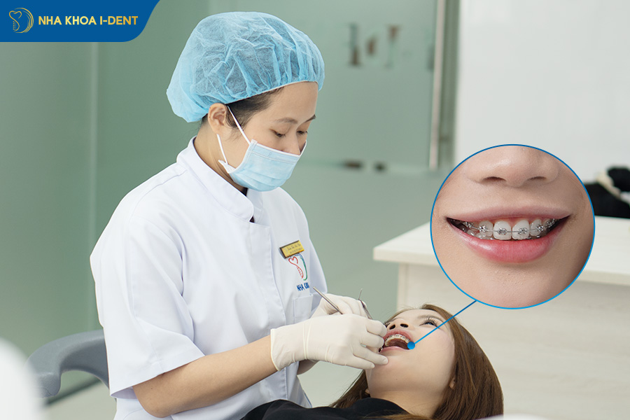 những người không nên niềng răng