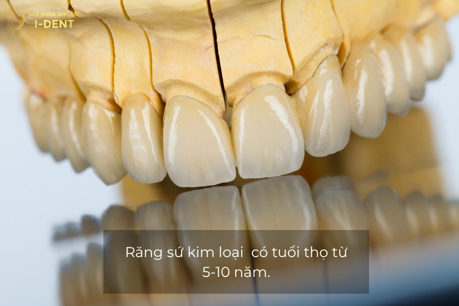 tuổi thọ răng sứ