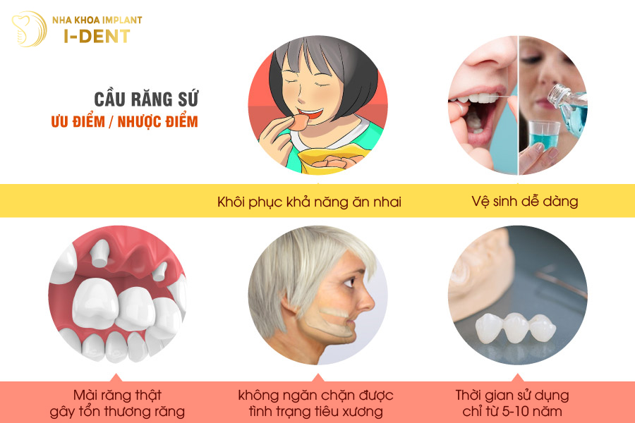 các loại răng giả