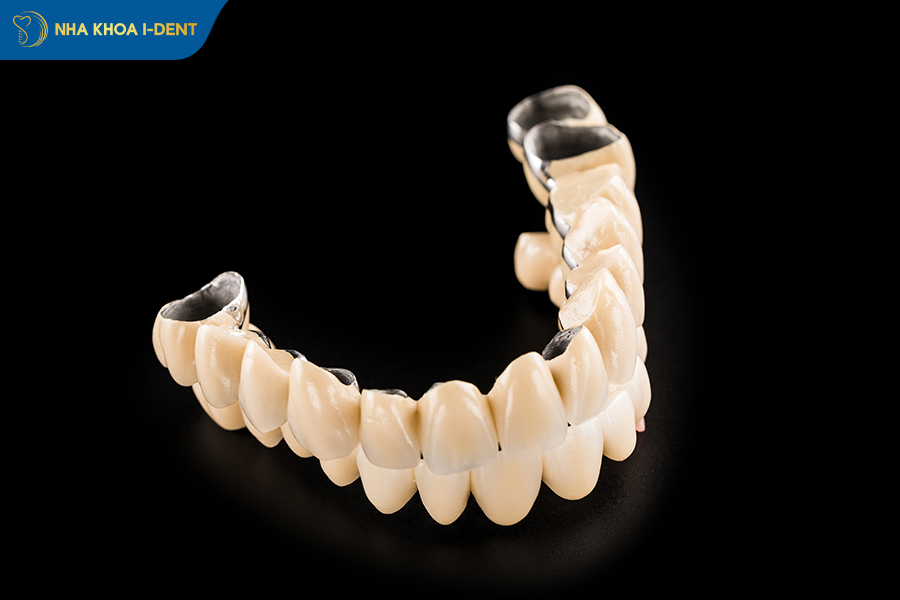 bọc răng sứ bao lâu thì phải làm lại