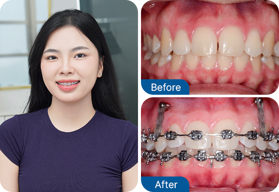 Ms. Duong Hoang Tu Uyen